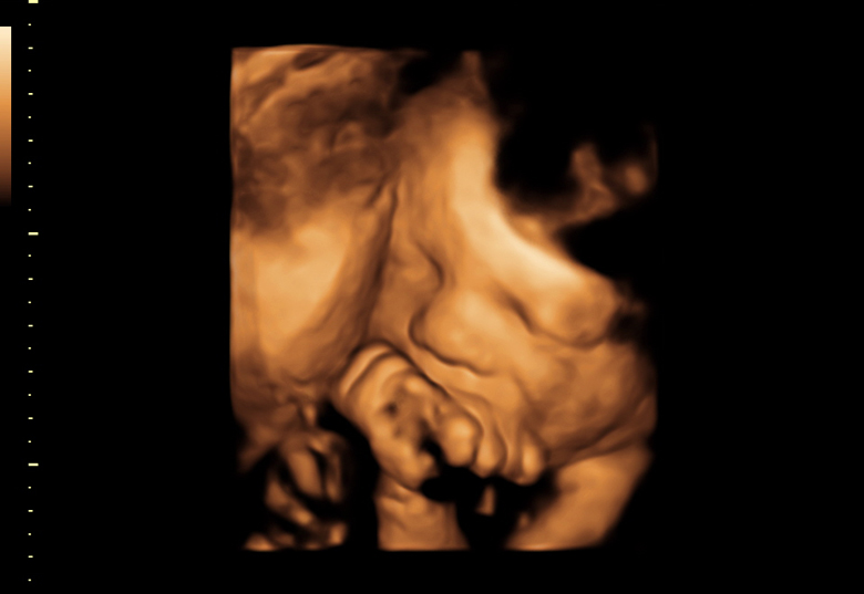 płód podczas badania USG
